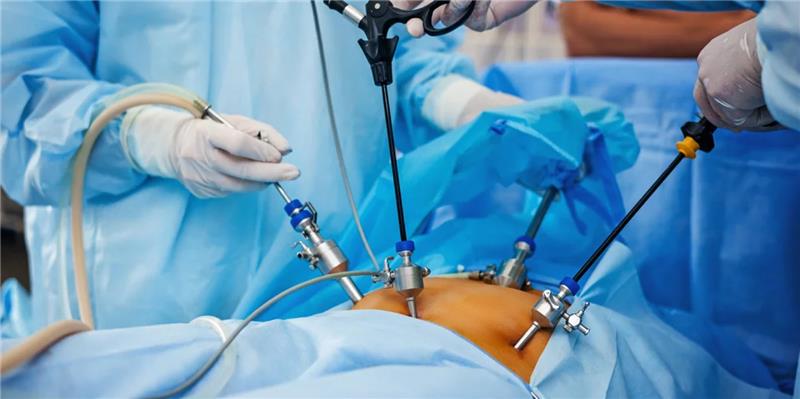 Laparoscopic Surgery